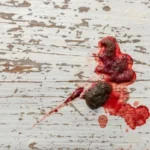 el_vomito_de_sangre_23388_0_600